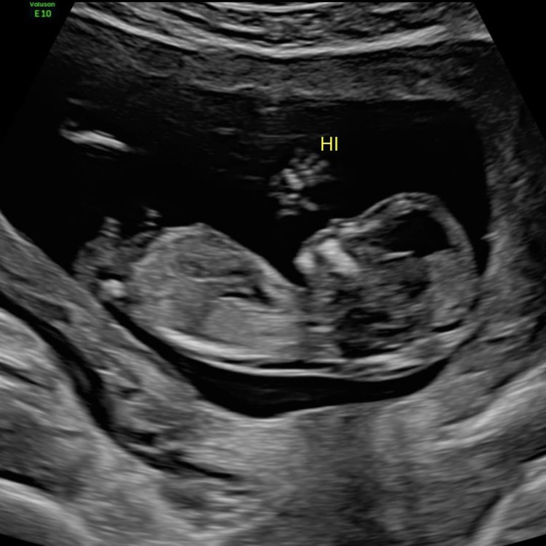 Photo shared by Anna for their Babylist baby registry.