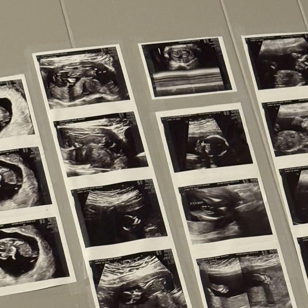 Photo shared by Fabian for their Babylist baby registry.