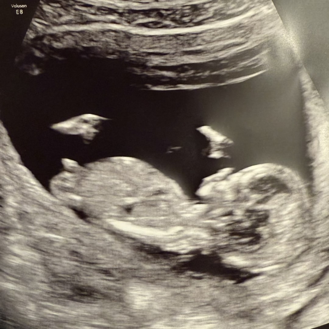 Photo shared by Elysa for their Babylist baby registry.