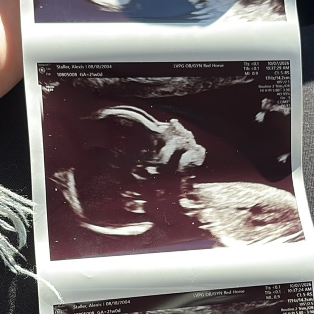Photo shared by Alexis for their Babylist baby registry.