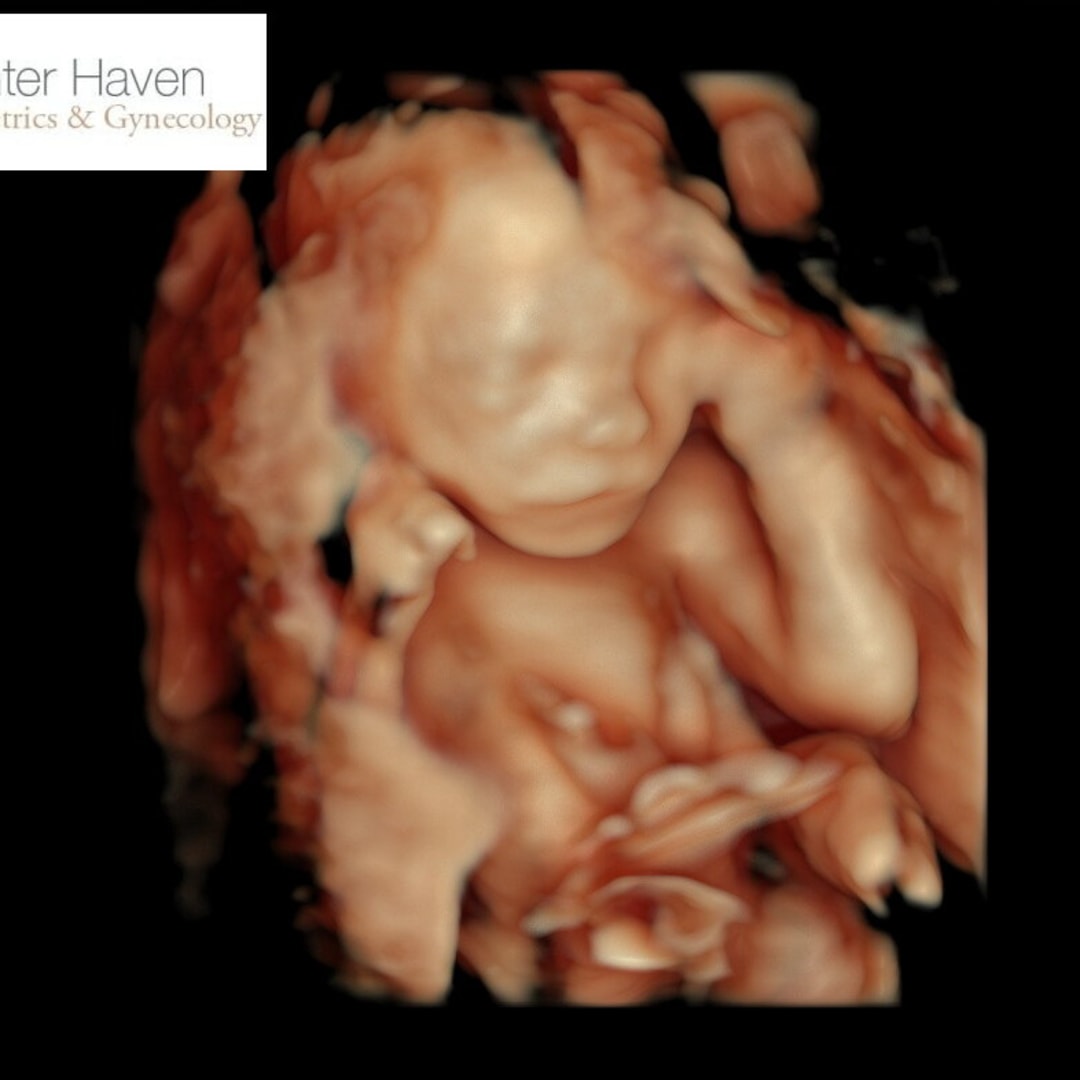 Photo shared by Laura for their Babylist baby registry.