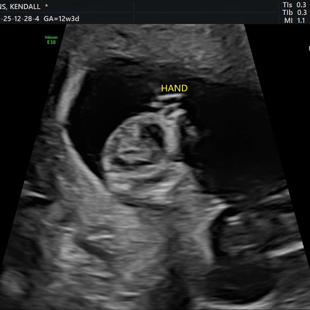 Photo shared by Kendall and Aj for their Babylist baby registry.