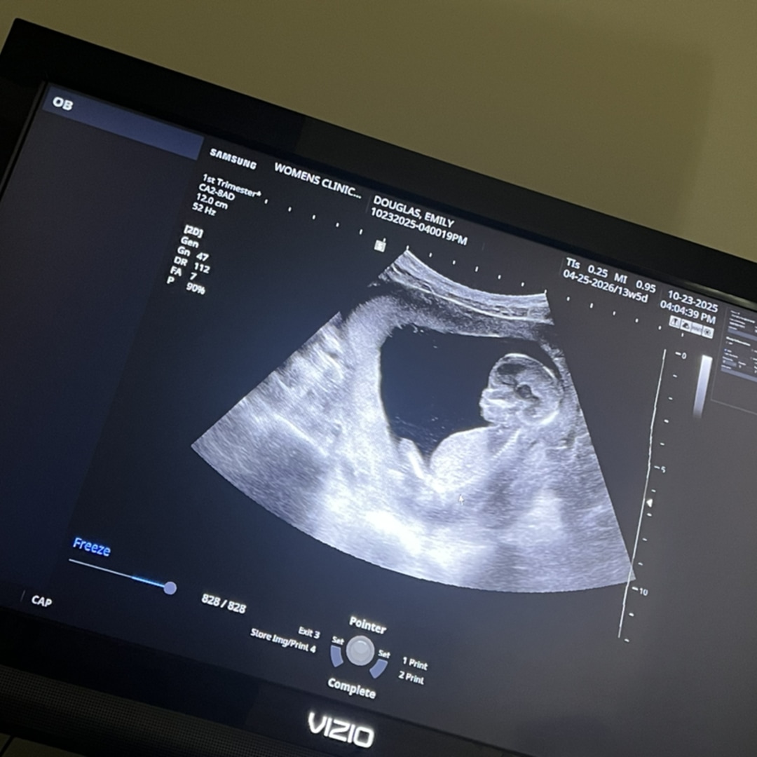 Photo shared by Emily for their Babylist baby registry.