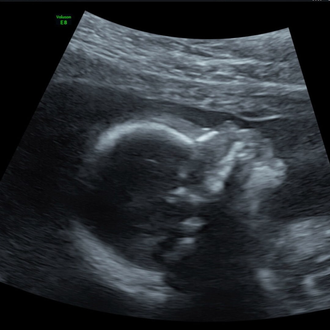 Photo shared by Ashleigh for their Babylist baby registry.