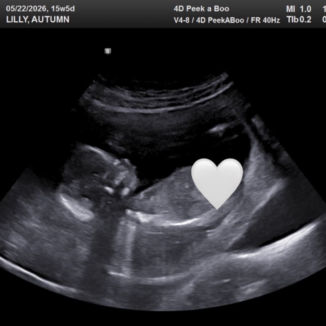 Photo shared by Autumn for their Babylist baby registry.