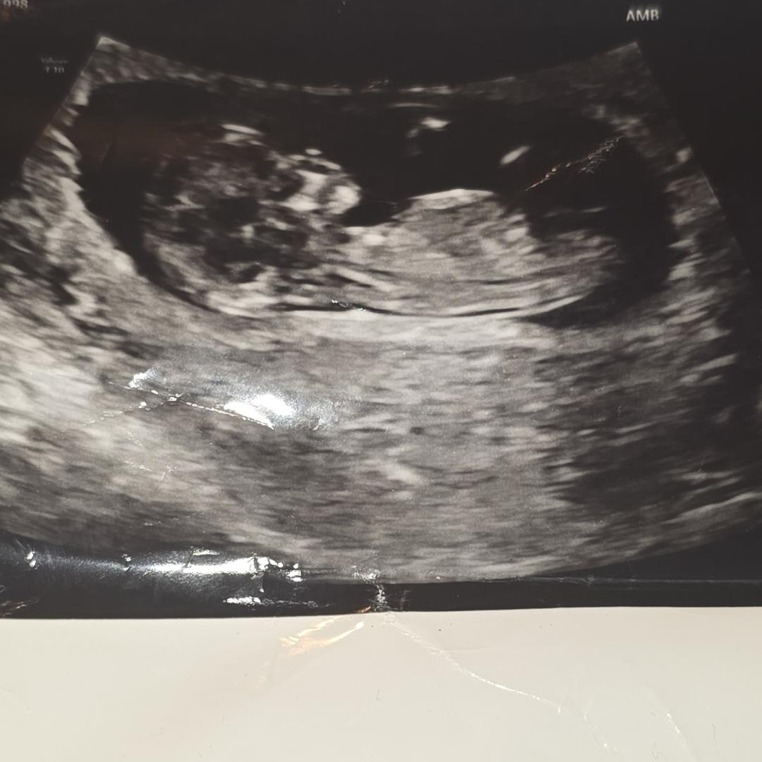Photo shared by Makaila for their Babylist baby registry.