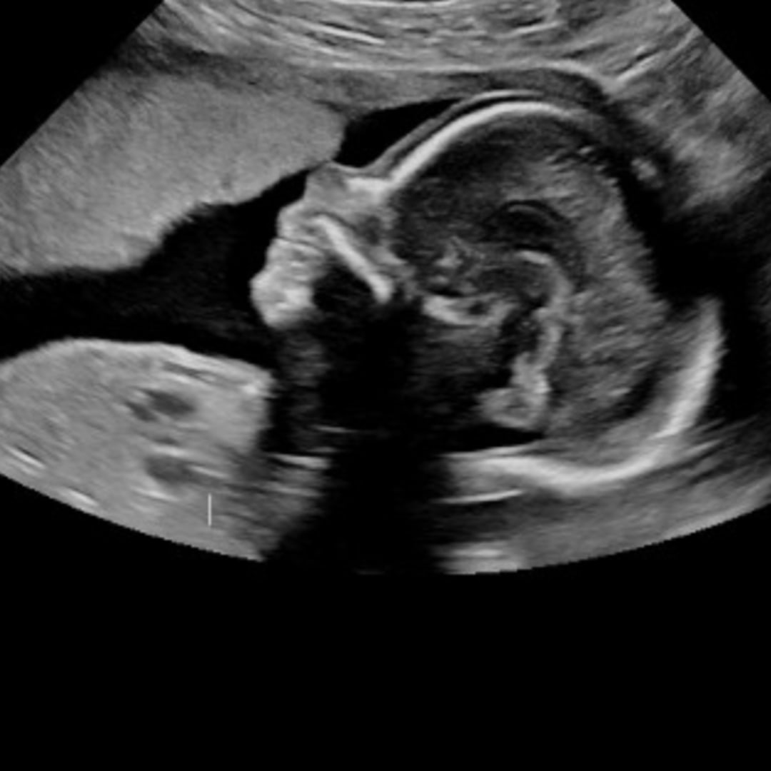 Photo shared by Olivia for their Babylist baby registry.