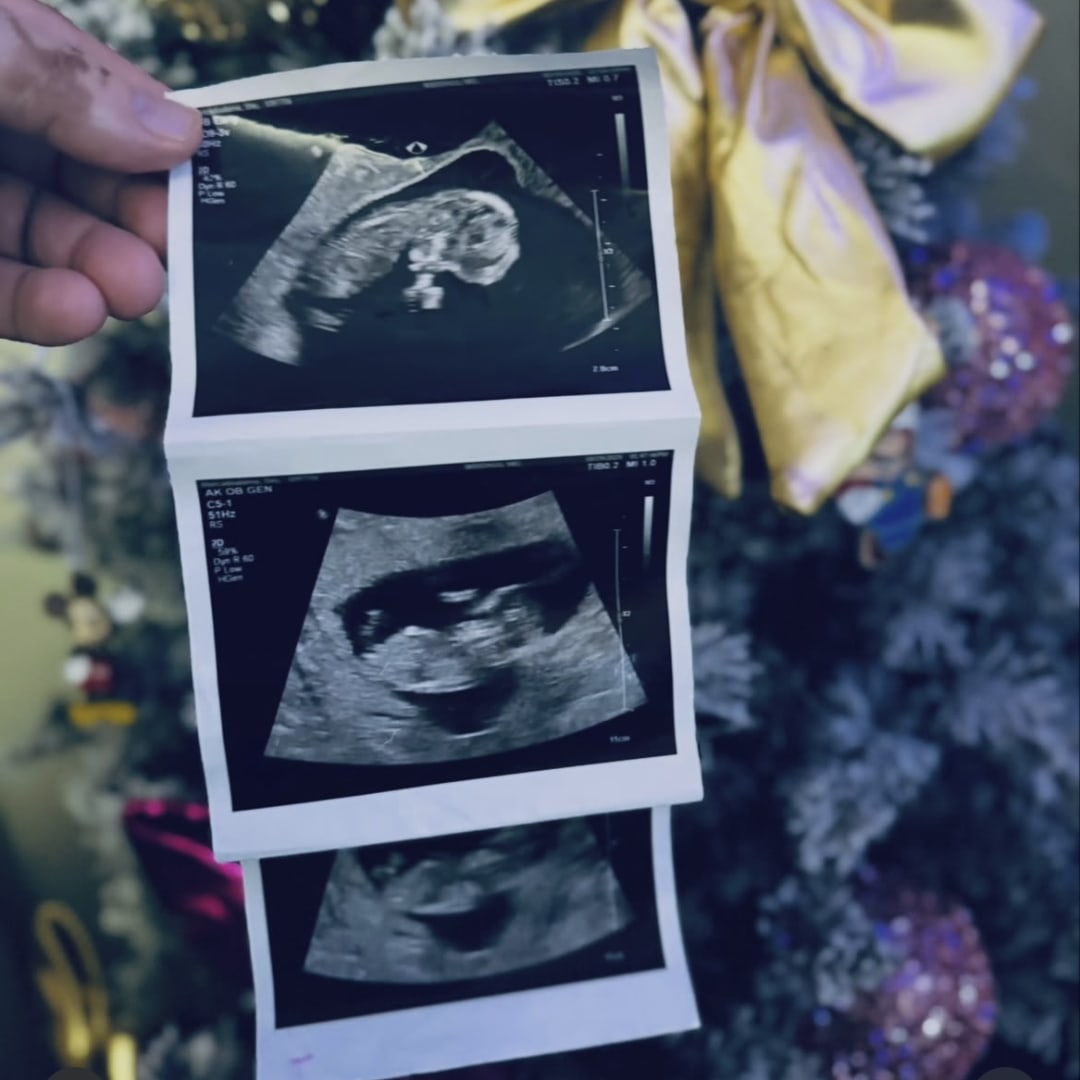 Photo shared by Stephanie for their Babylist baby registry.