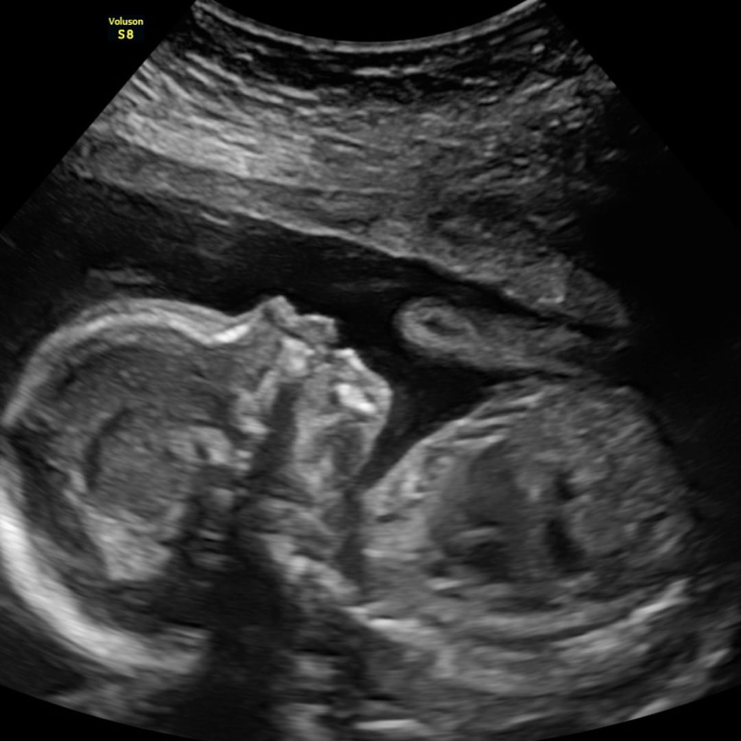 Photo shared by Raegan for their Babylist baby registry.
