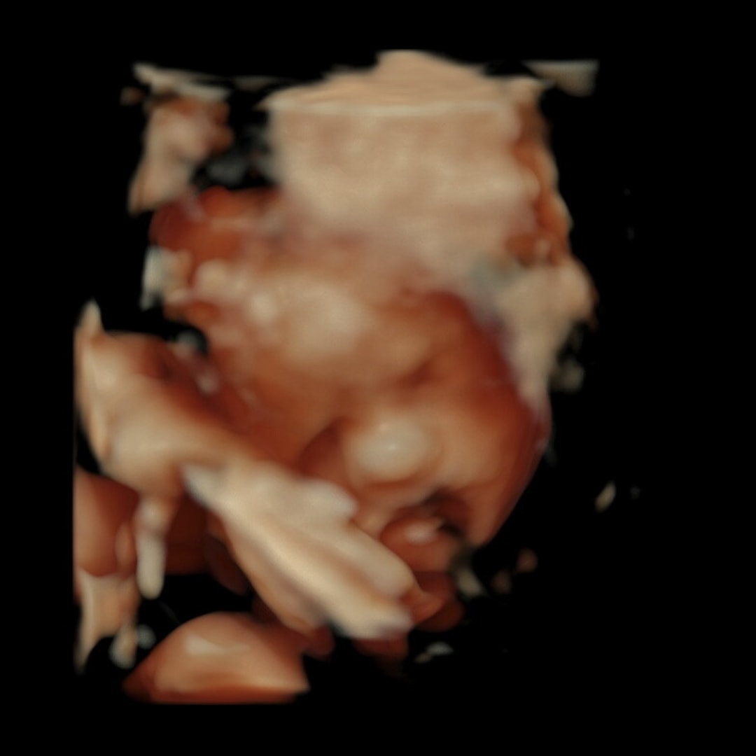 Photo shared by Harlie for their Babylist baby registry.