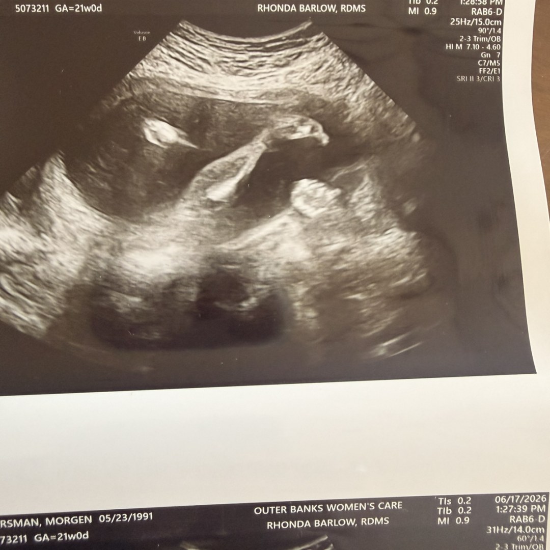 Photo shared by Morgen for their Babylist baby registry.