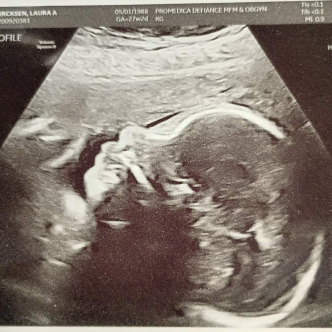 Photo shared by Laura for their Babylist baby registry.