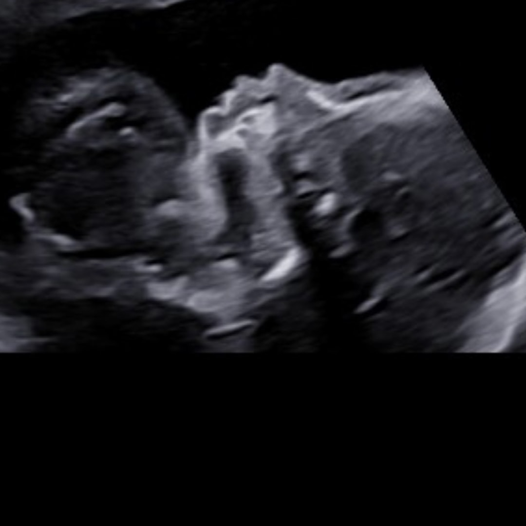 Photo shared by Payton for their Babylist baby registry.