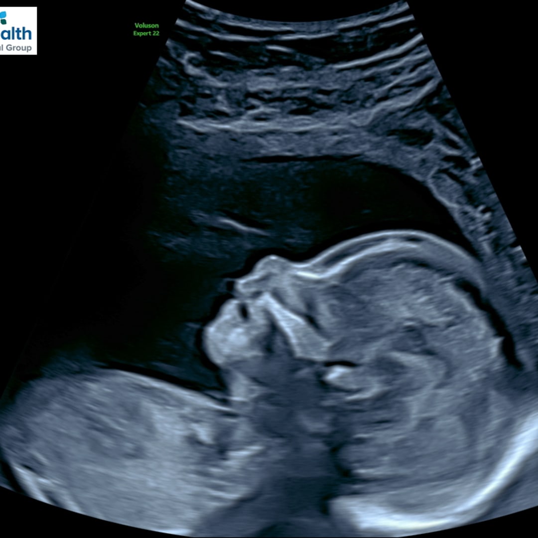 Photo shared by Caroline for their Babylist baby registry.