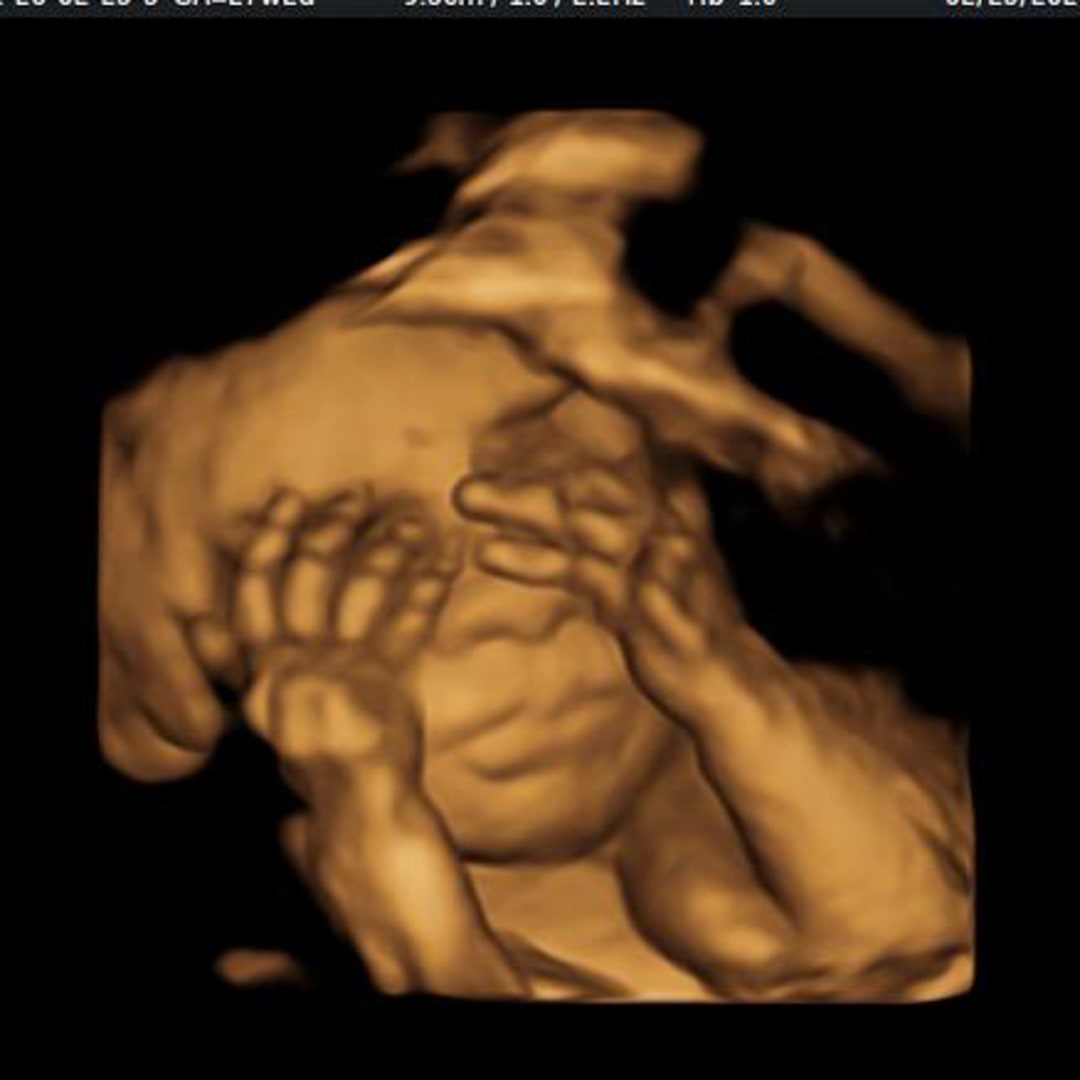 Photo shared by Jenni for their Babylist baby registry.