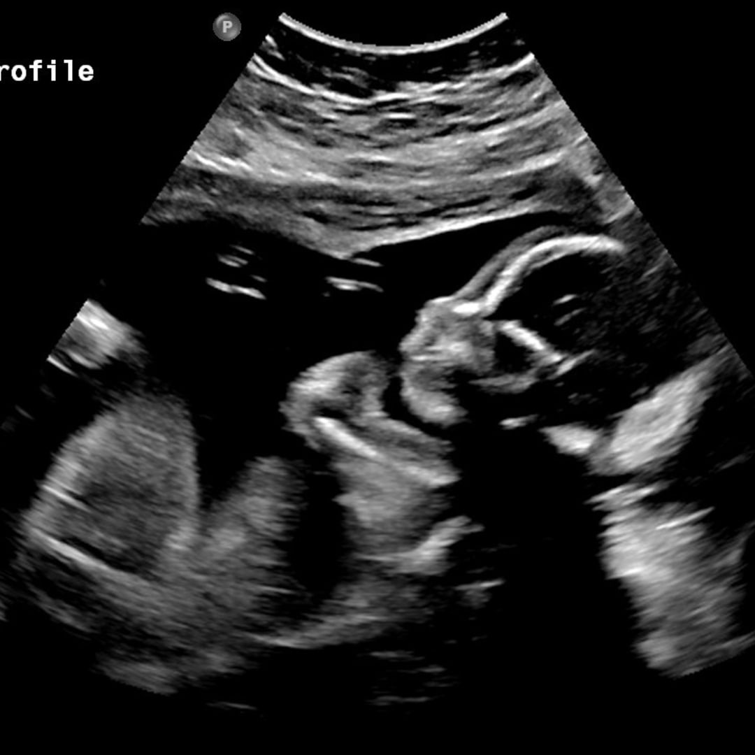 Photo shared by Maddy for their Babylist baby registry.
