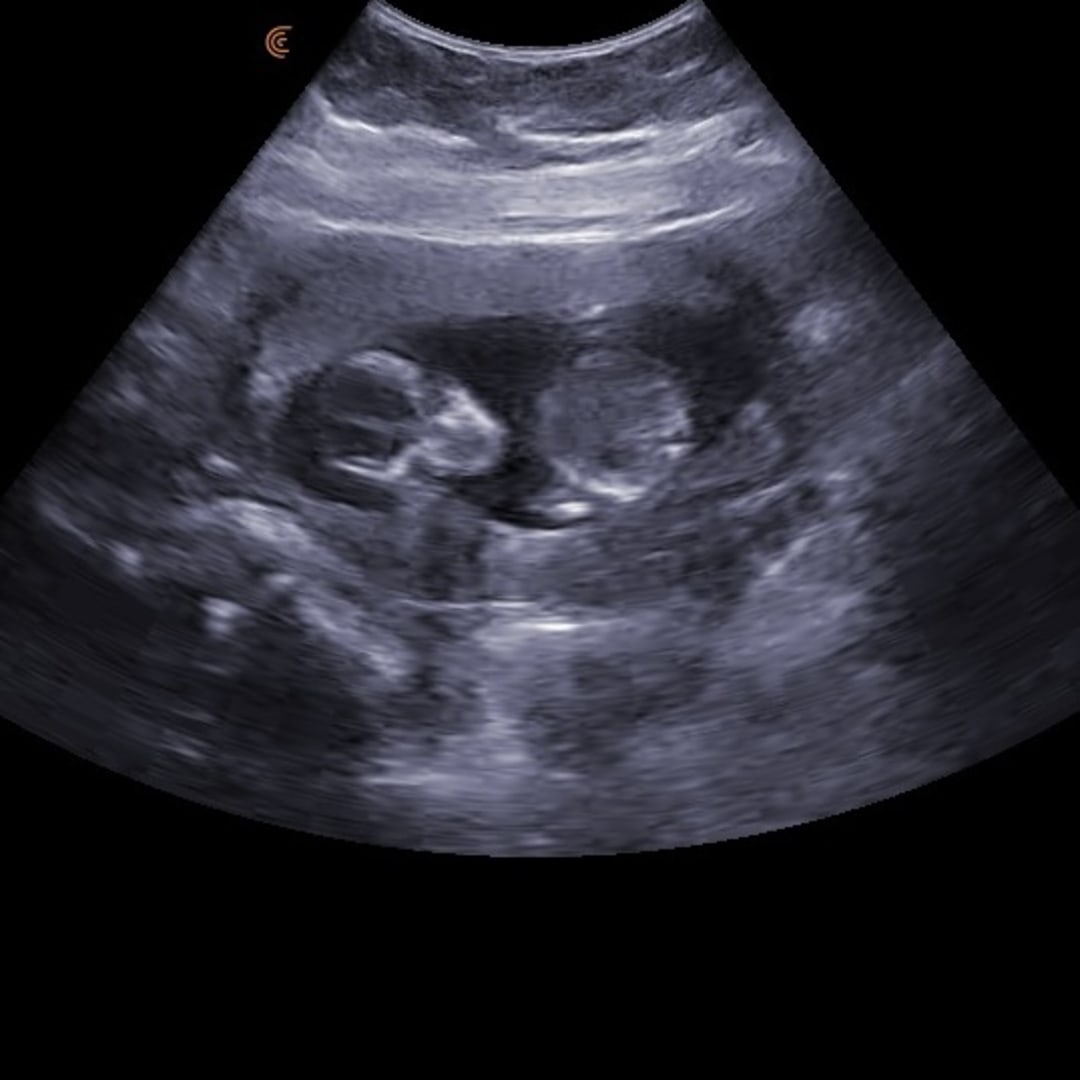 Photo shared by Erika for their Babylist baby registry.