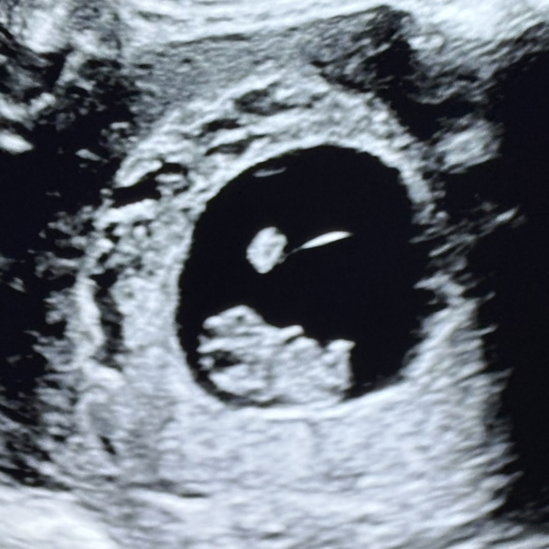 Photo shared by Savannah for their Babylist baby registry.