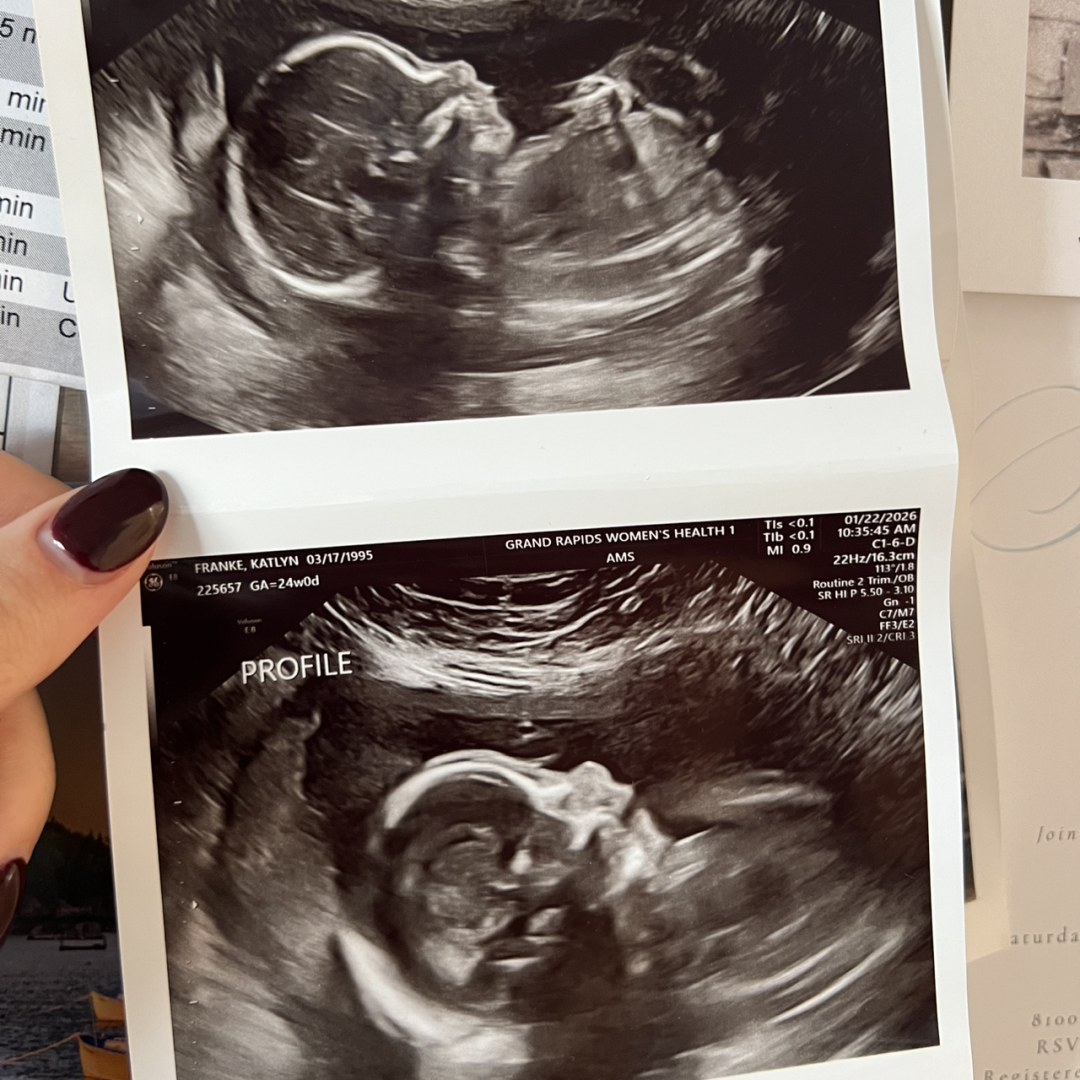 Photo shared by Katie for their Babylist baby registry.