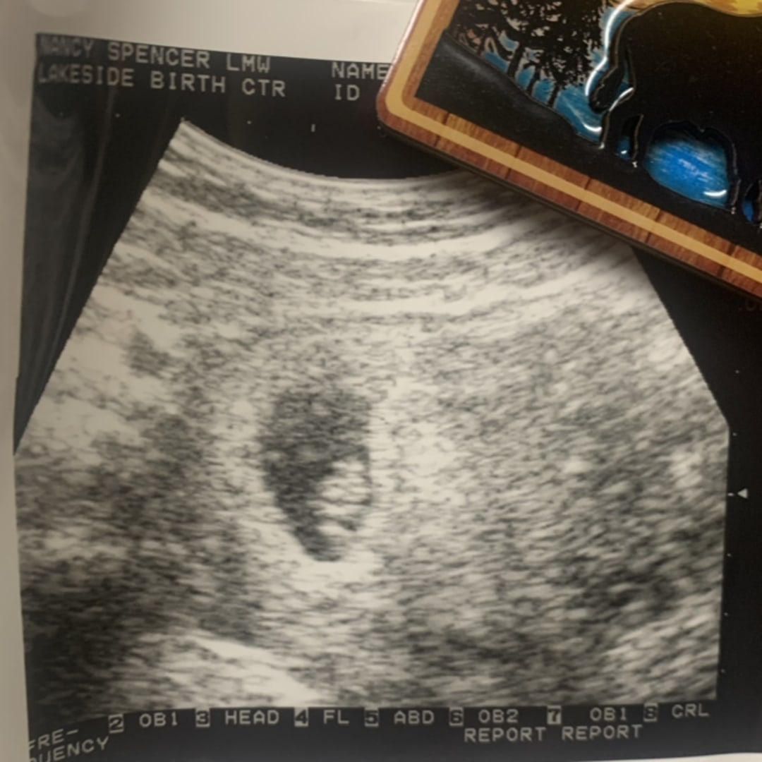 Photo shared by Emily for their Babylist baby registry.