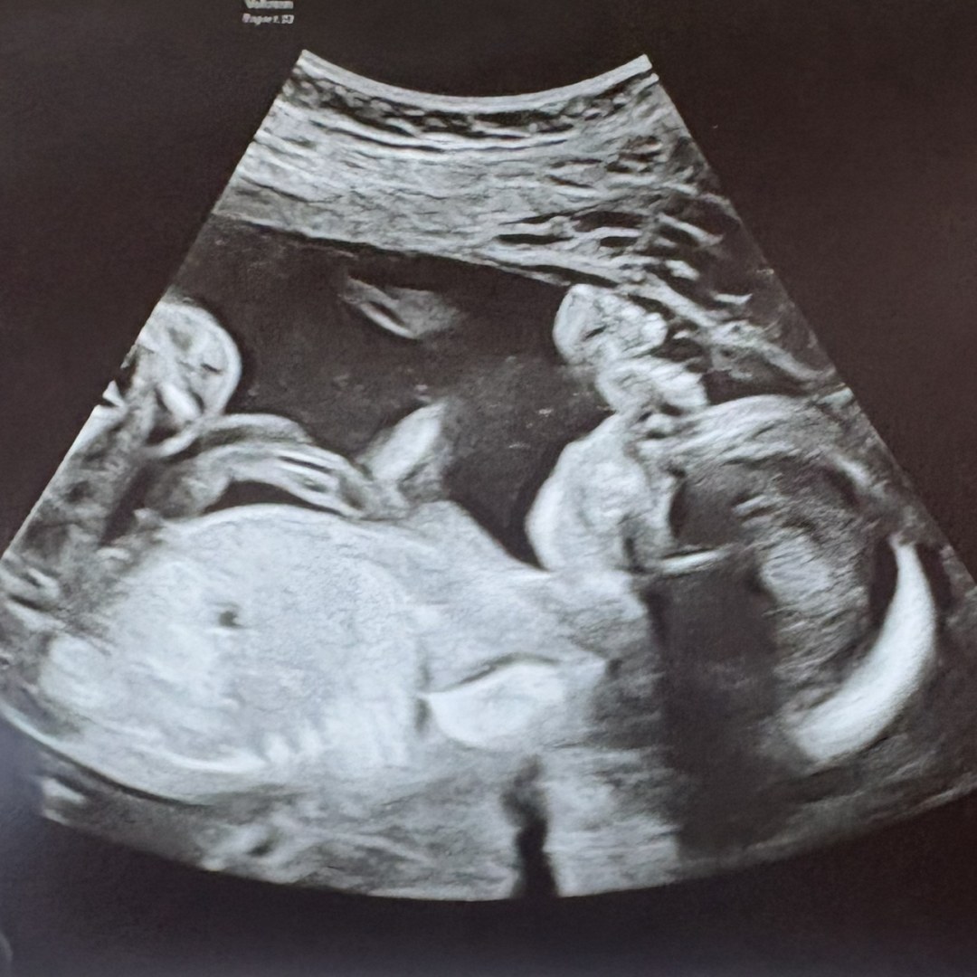 Photo shared by Isabela for their Babylist baby registry.