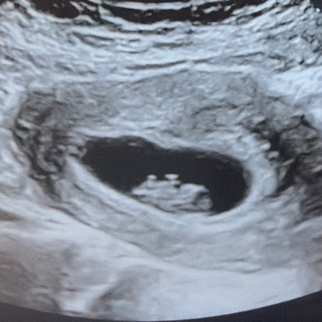 Photo shared by Angel for their Babylist baby registry.