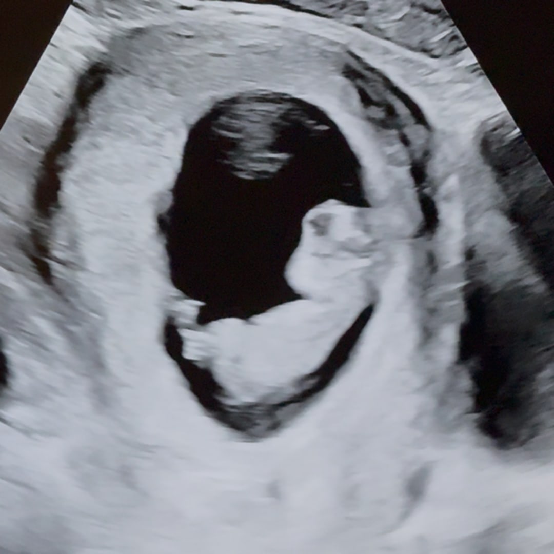 Photo shared by Kaitlyn for their Babylist baby registry.