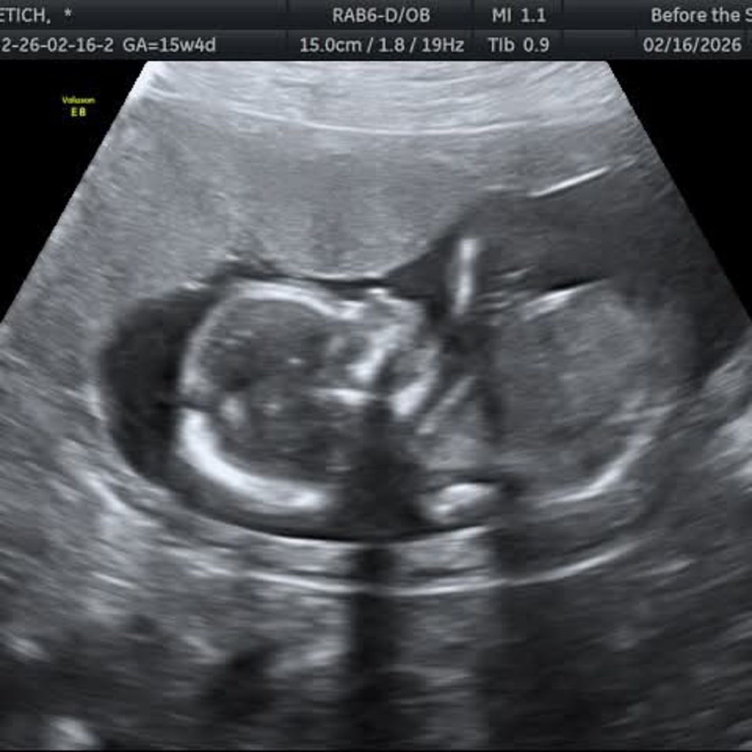 Photo shared by Alyssa for their Babylist baby registry.