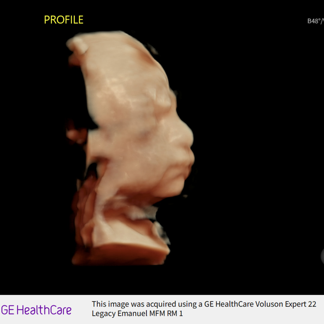 Photo shared by Chloe for their Babylist baby registry.