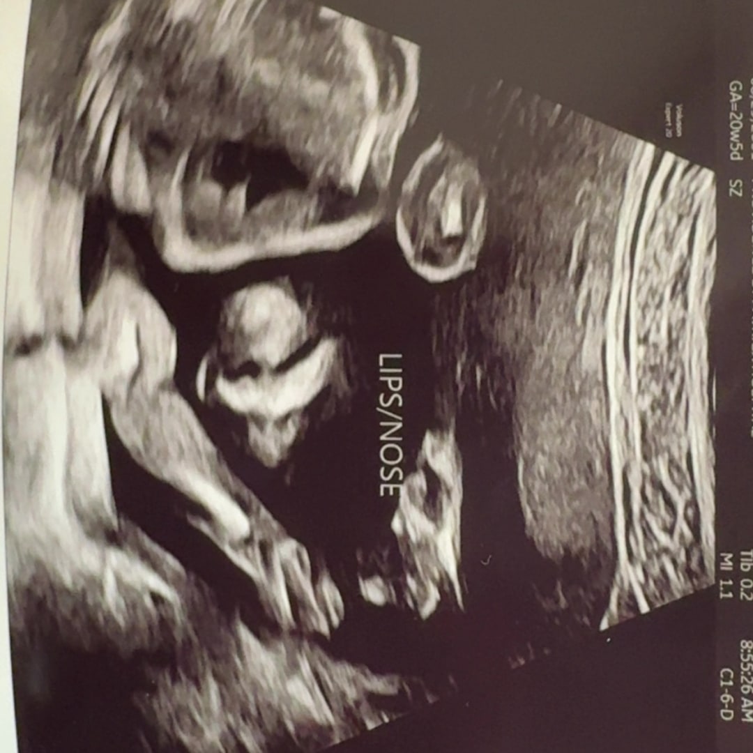 Photo shared by Kylee for their Babylist baby registry.