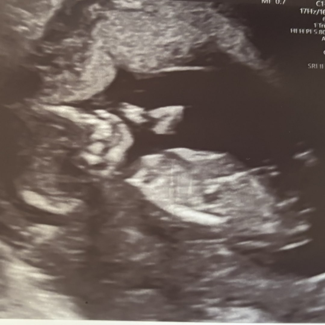 Photo shared by Alexis for their Babylist baby registry.