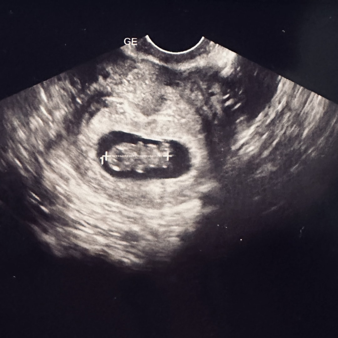 Photo shared by Esther for their Babylist baby registry.
