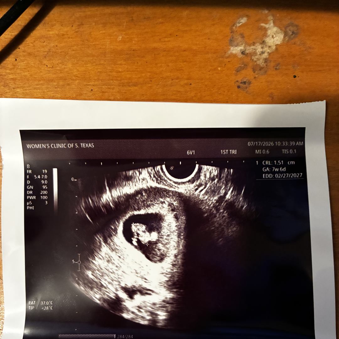 Photo shared by Alyssa for their Babylist baby registry.