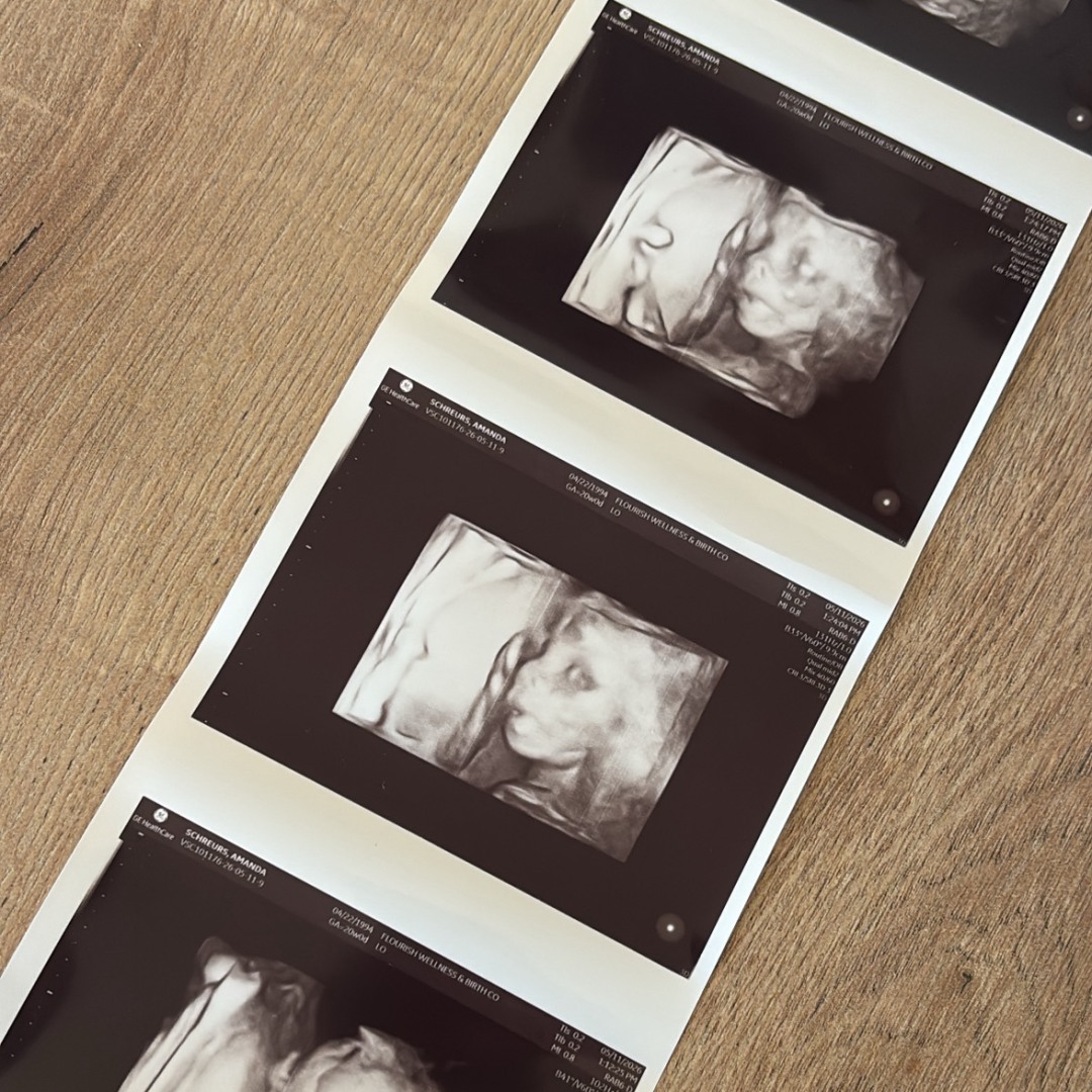 Photo shared by Amanda for their Babylist baby registry.