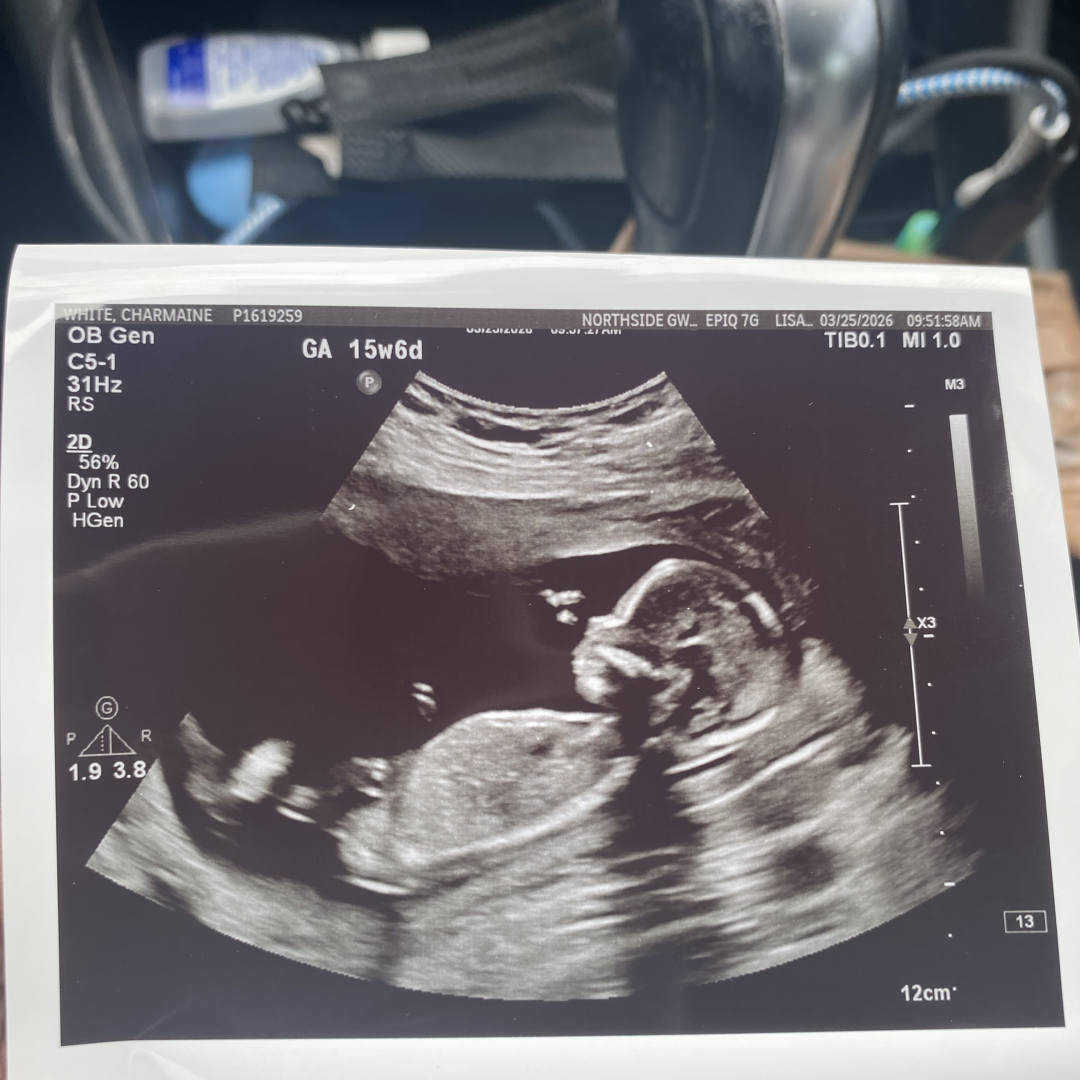 Photo shared by Charmaine for their Babylist baby registry.