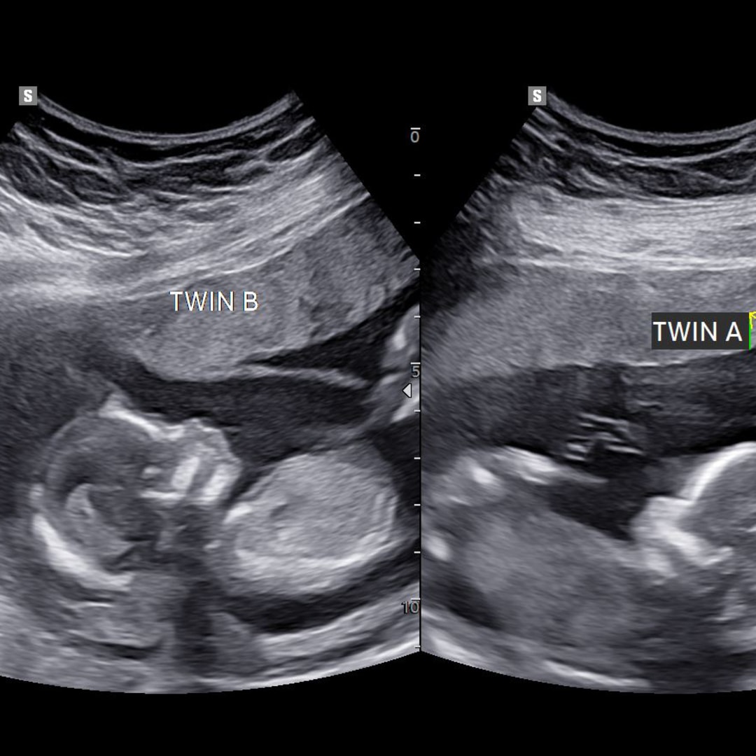 Photo shared by Sandra for their Babylist baby registry.