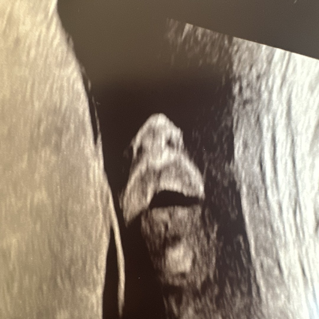 Photo shared by Jett for their Babylist baby registry.