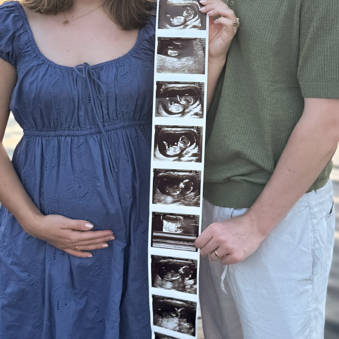 Photo shared by Christina & Jacob for their Babylist baby registry.