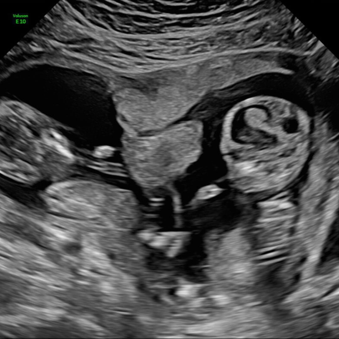 Photo shared by Abby for their Babylist baby registry.