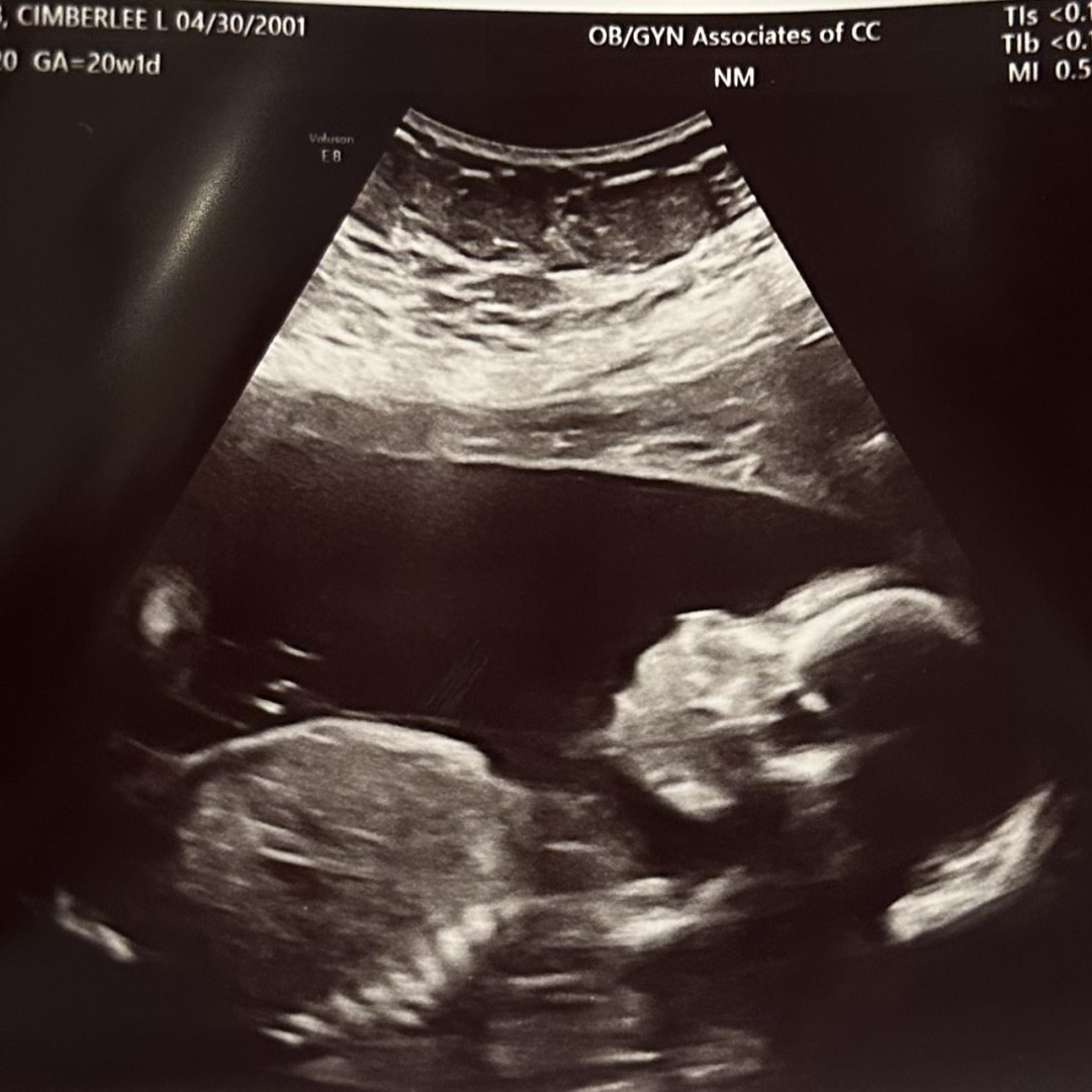 Photo shared by Cimberlee for their Babylist baby registry.