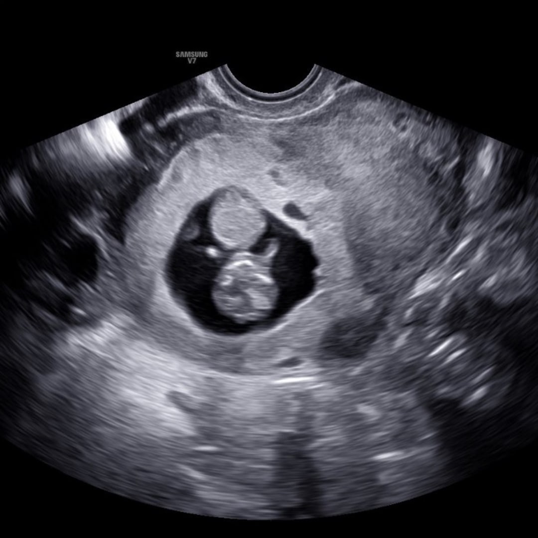 Photo shared by Samantha for their Babylist baby registry.