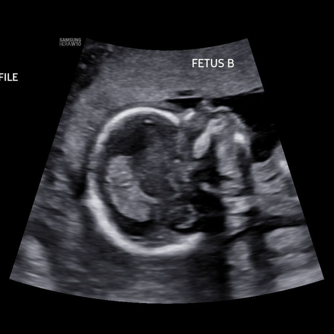 Photo shared by Gabrielle for their Babylist baby registry.