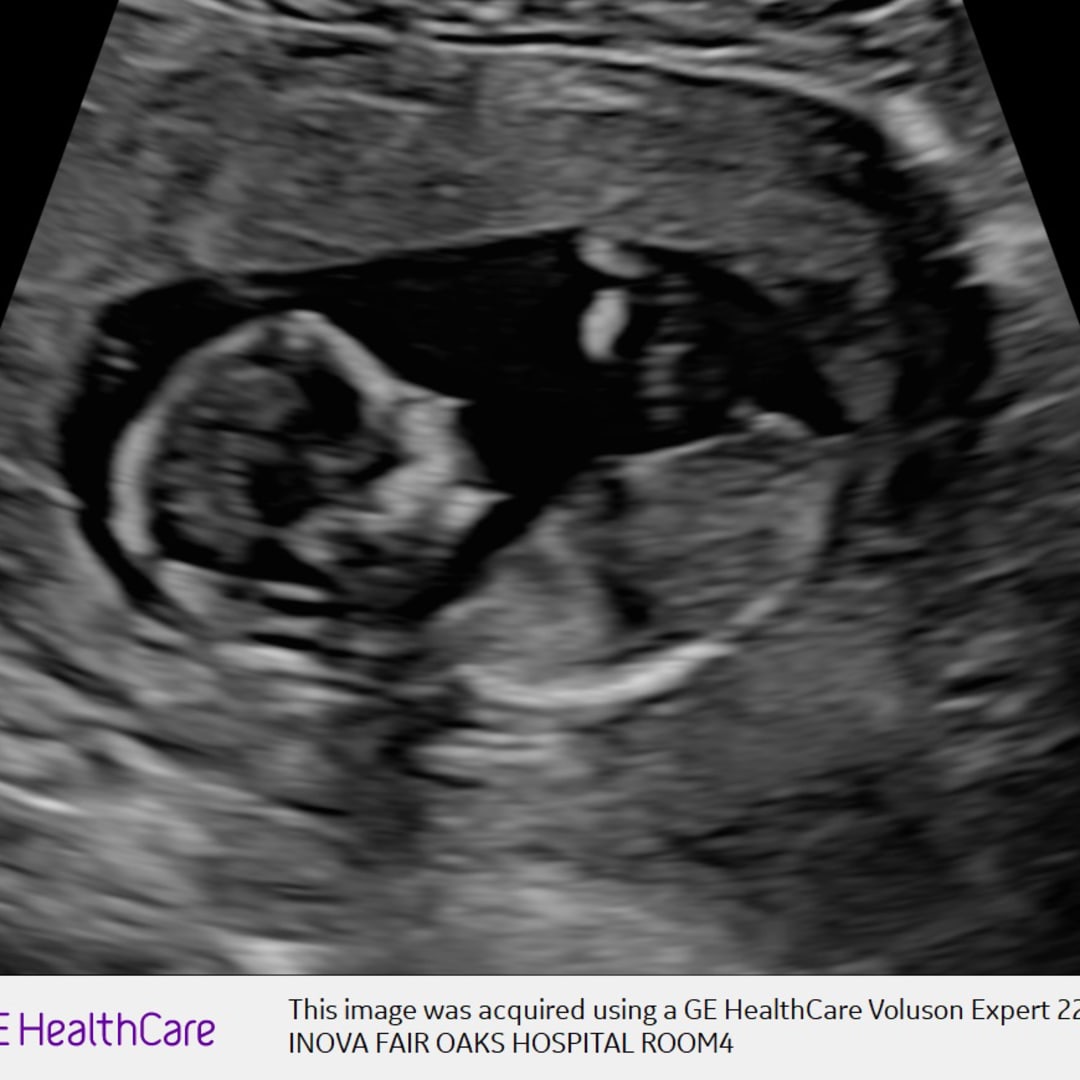 Photo shared by Lindsay for their Babylist baby registry.