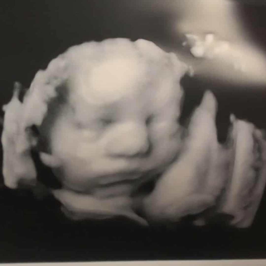 Photo shared by Sierra for their Babylist baby registry.
