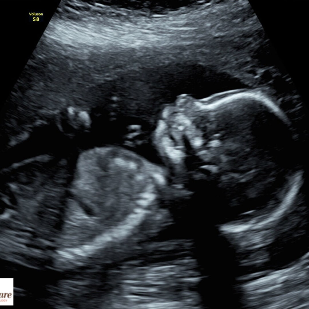 Photo shared by Alexis for their Babylist baby registry.