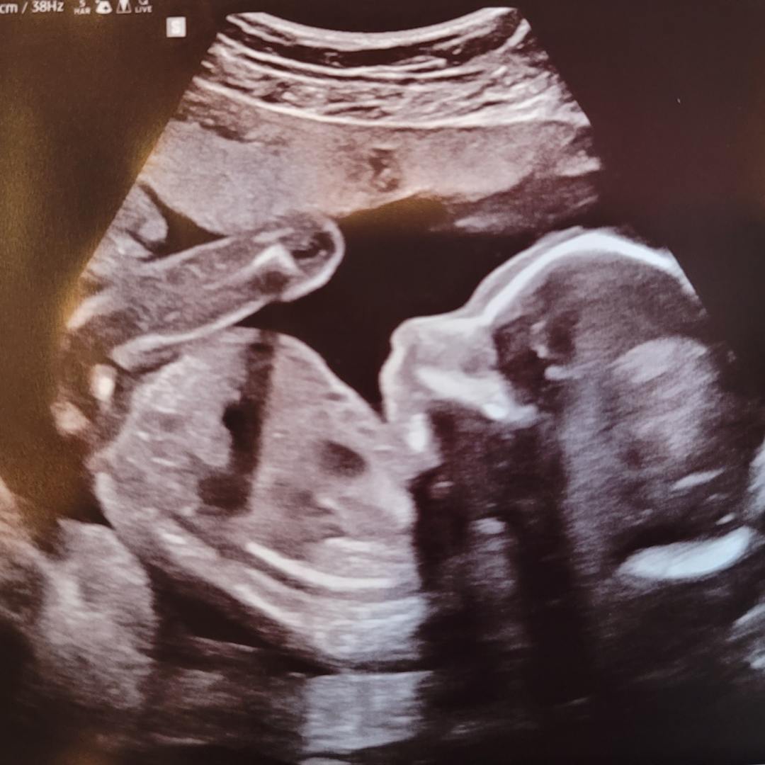 Photo shared by Valerie for their Babylist baby registry.