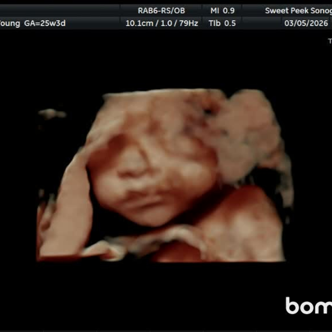 Photo shared by Amber for their Babylist baby registry.