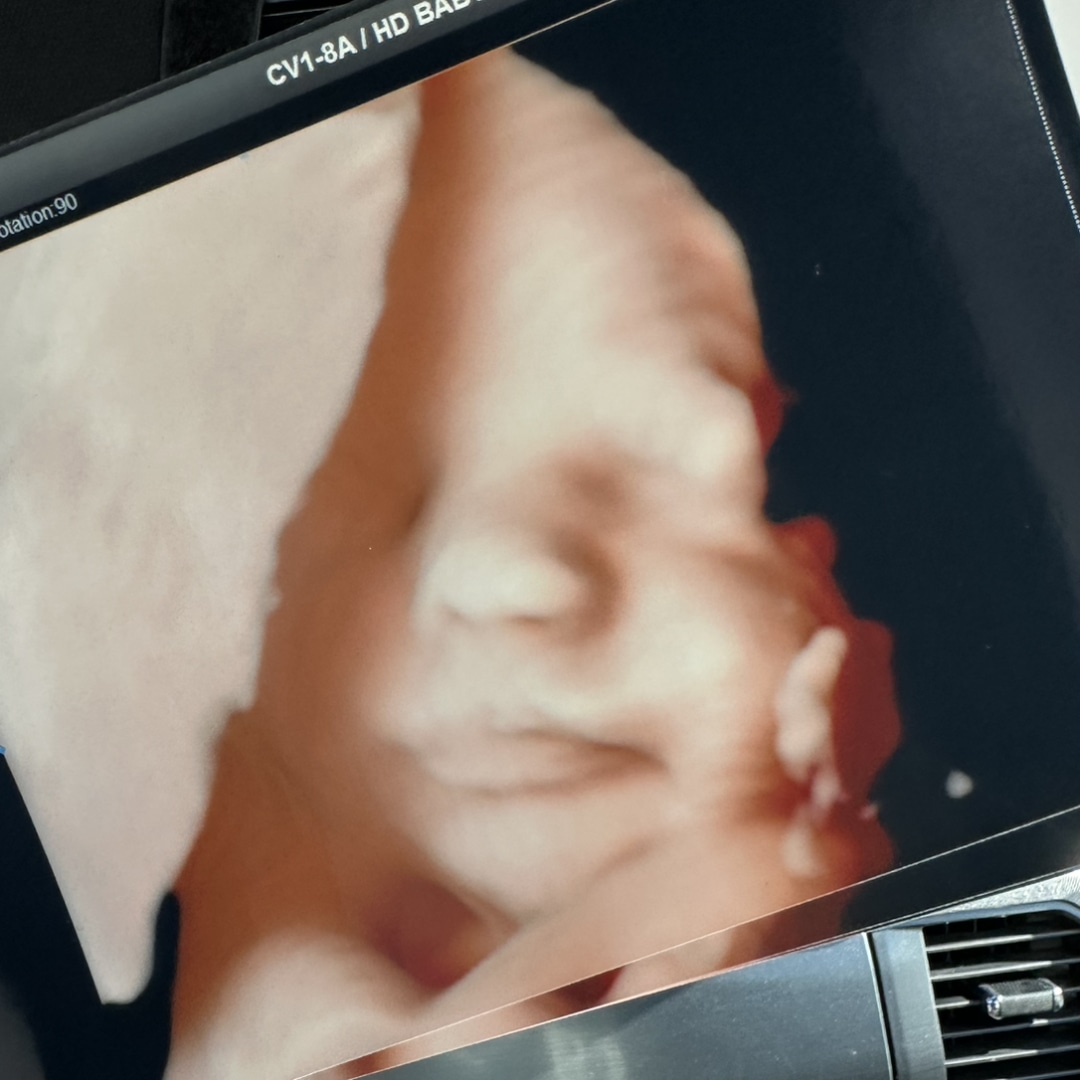 Photo shared by Abby for their Babylist baby registry.