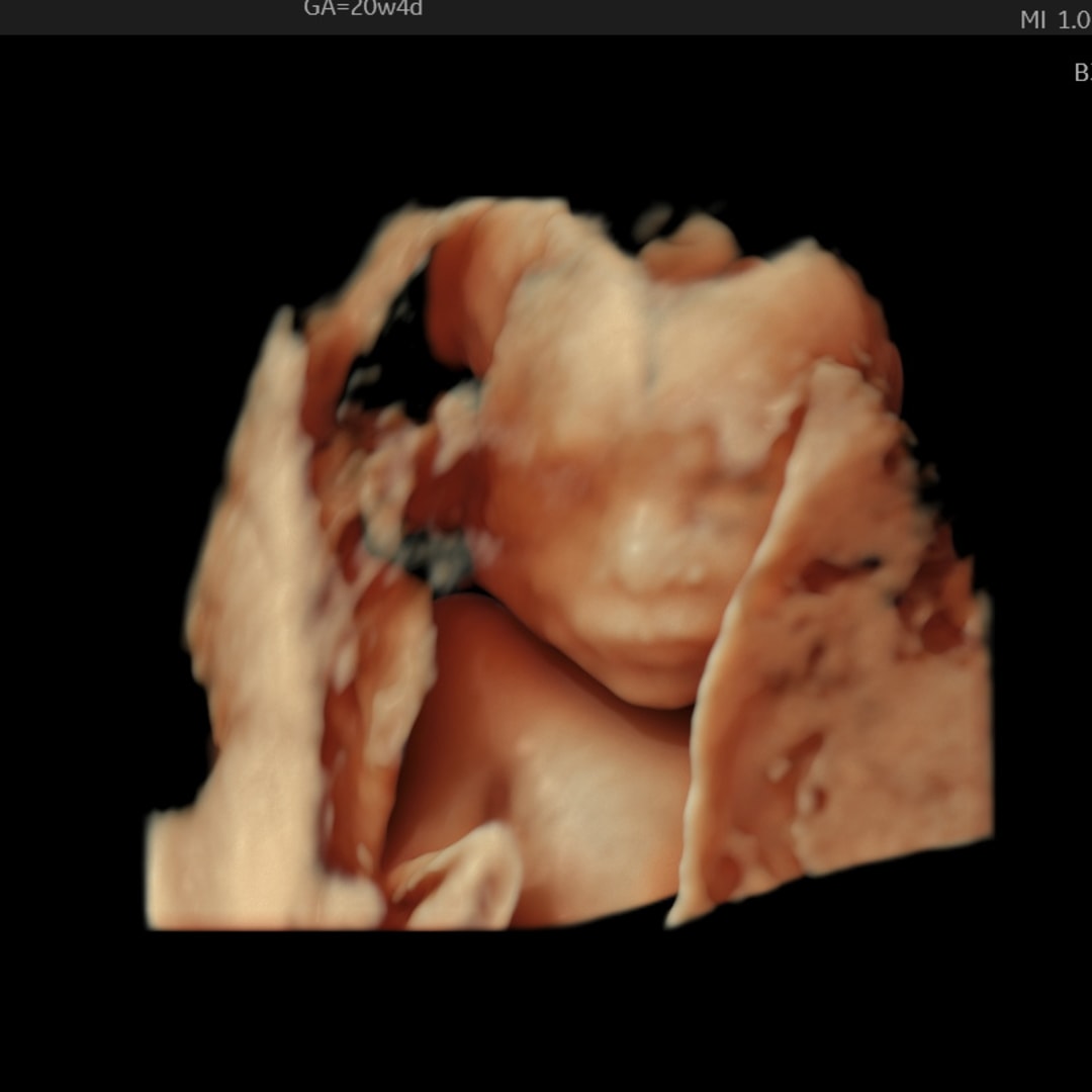 Photo shared by Nyla for their Babylist baby registry.