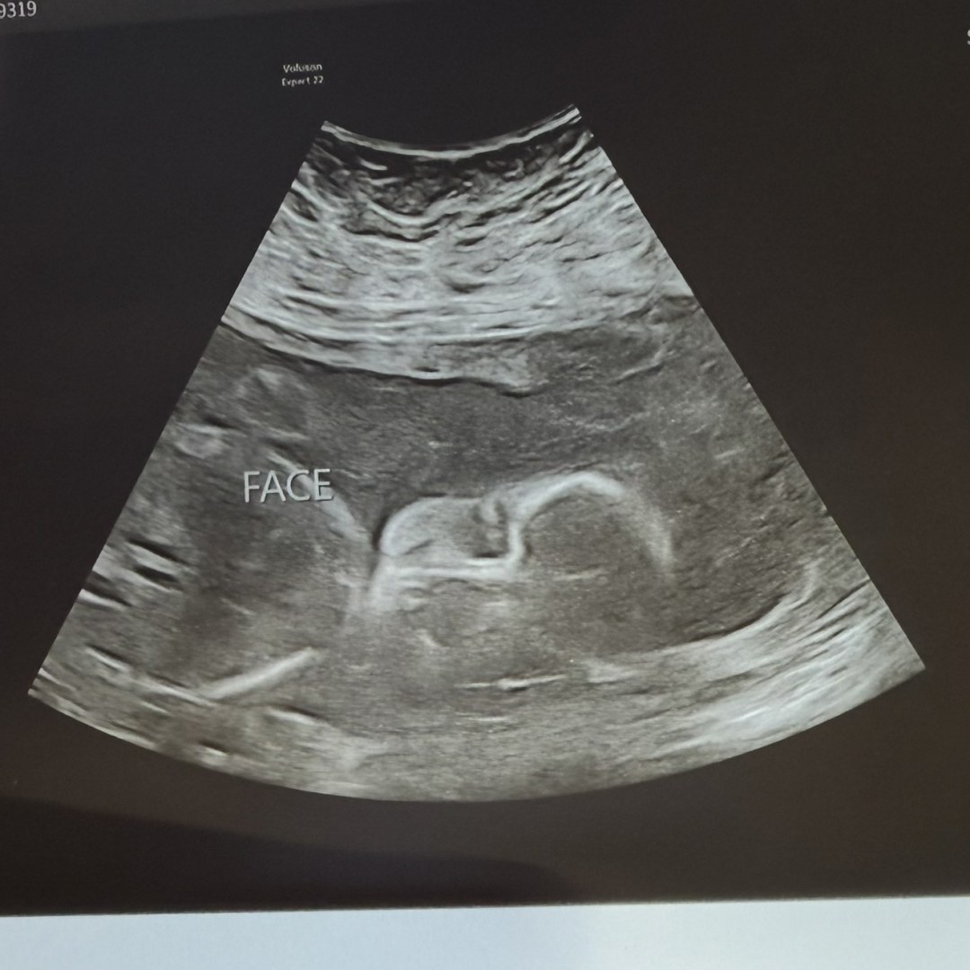 Photo shared by Alicia for their Babylist baby registry.